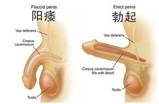 厦门男人阳痿如何治